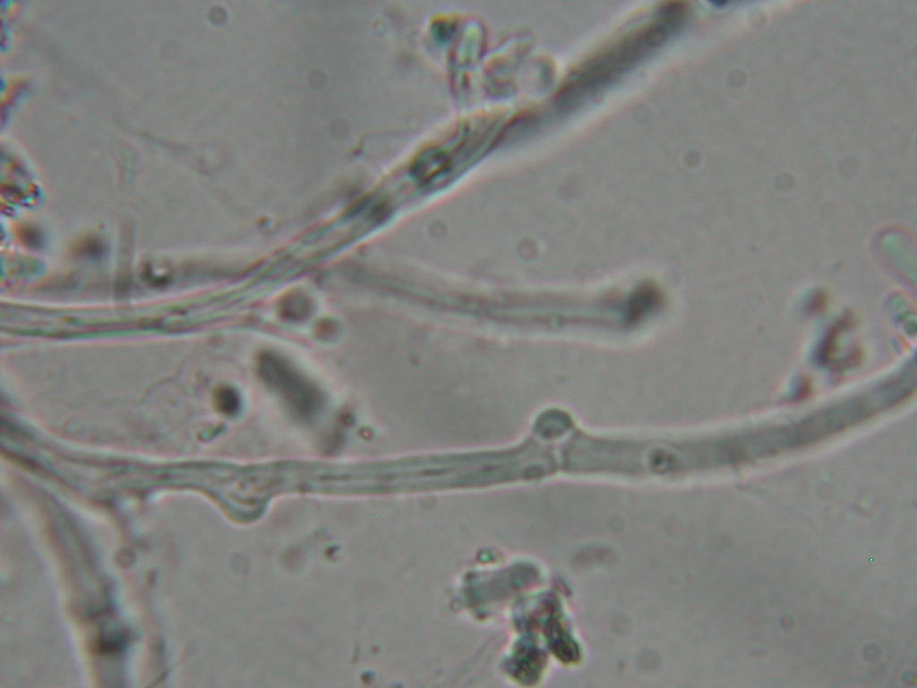 Da determinare...  (Dacryobolus karstenii)